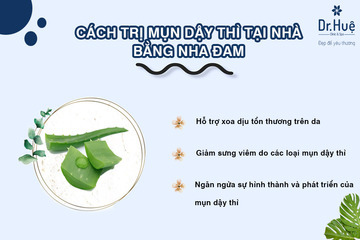 Gợi ý 5 cách trị mụn dậy thì tại nhà hiệu quả sau 1 đêm