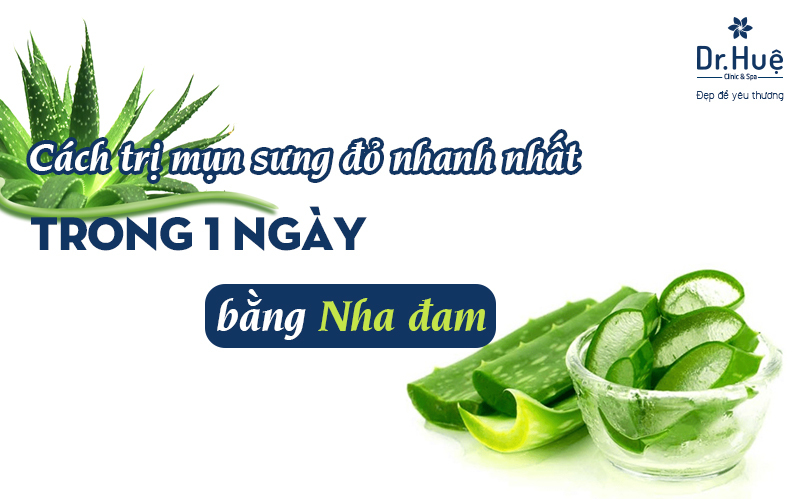 Cách trị mụn sưng đỏ nhanh nhất trong 1 ngày tại nhà bằng nha đam